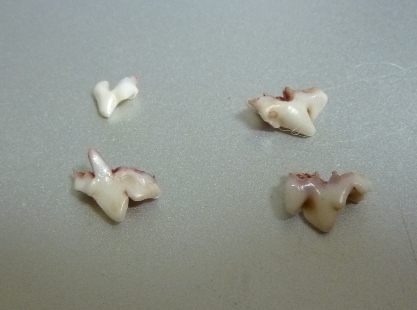 琥珀の歯